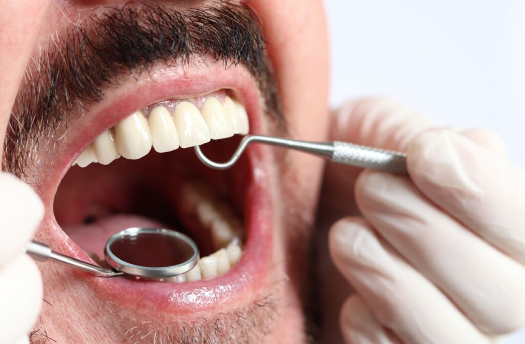 A close up of a dentist using tools to examine a persons teeth