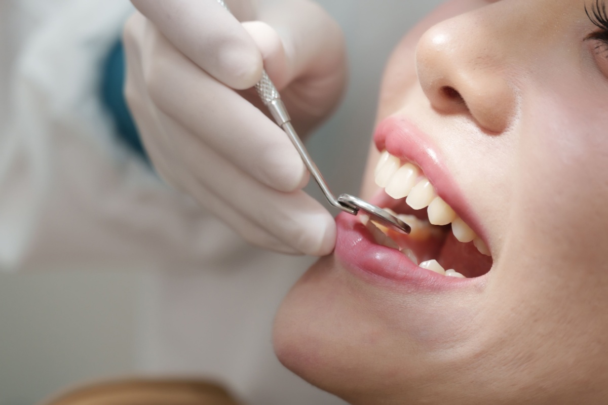 A person getting their teeth looked at during an routine dental cleaning